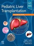 Hadzic / Baumann / MCLIN |  Pediatric Liver Transplantation: A Clinical Guide | Buch |  Sack Fachmedien