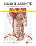 Gough |  Injury Illustrated | Buch |  Sack Fachmedien