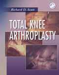 Scott |  Total Knee Arthroplasty | Buch |  Sack Fachmedien