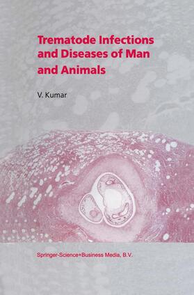 Kumar | Trematode Infections and Diseases of Man and Animals | Buch | sack.de
