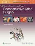 Johnson |  Master Techniques in Orthopaedic Surgery: Reconstructive Kne | Buch |  Sack Fachmedien