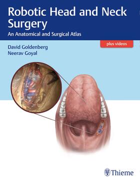 Goldenberg / Goyal | Robotic Head and Neck Surgery | Buch | sack.de
