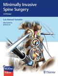 Tumialan |  Minimally Invasive Spine Surgery | Buch |  Sack Fachmedien