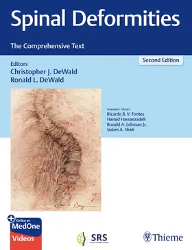 DeWald |  Spinal Deformities | Buch |  Sack Fachmedien