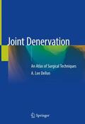 Dellon |  Joint Denervation | Buch |  Sack Fachmedien