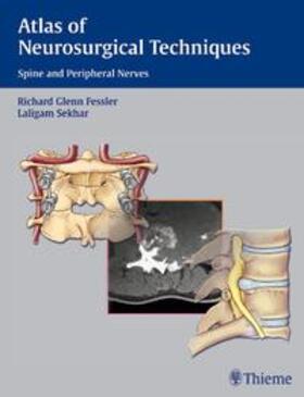 Fessler / Sekhar | Atlas of Neurosurgical Techniques | Buch | sack.de