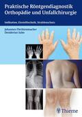 Flechtenmacher / Angenendt / Sabo |  Praktische Röntgendiagnostik Orthopädie und Unfallchirurgie | eBook | Sack Fachmedien