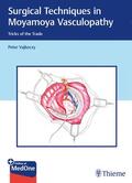Vajkoczy |  Surgical Techniques in Moyamoya Vasculopathy | eBook | Sack Fachmedien