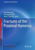 Biberthaler / Kirchhoff / Waddell |  Fractures of the Proximal Humerus | Buch |  Sack Fachmedien