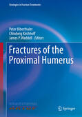 Biberthaler / Kirchhoff / Waddell |  Fractures of the Proximal Humerus | eBook | Sack Fachmedien