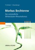 Baumberger / Schmied |  Morbus Bechterew | Buch |  Sack Fachmedien