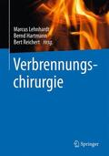 Lehnhardt / Hartmann / Reichert |  Verbrennungschirurgie | Buch |  Sack Fachmedien