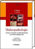 Thomas |  Makropathologie | Buch |  Sack Fachmedien