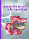 Khoury |  Augmentative Verfahren in der Implantologie | eBook | Sack Fachmedien